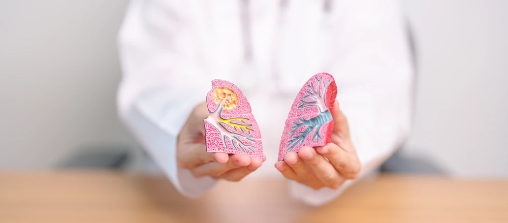 Le rôle primordial de la solidarité face aux manques de la Sécurité Sociale Santé Médecine 