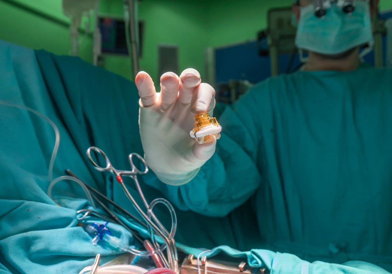 L'Iran émerge dans la production de valves cardiaques en tissu humain Santé Iran 